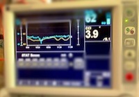 Cardiac Output monitor
